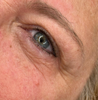 EyeFix Contorno occhi istantaneo