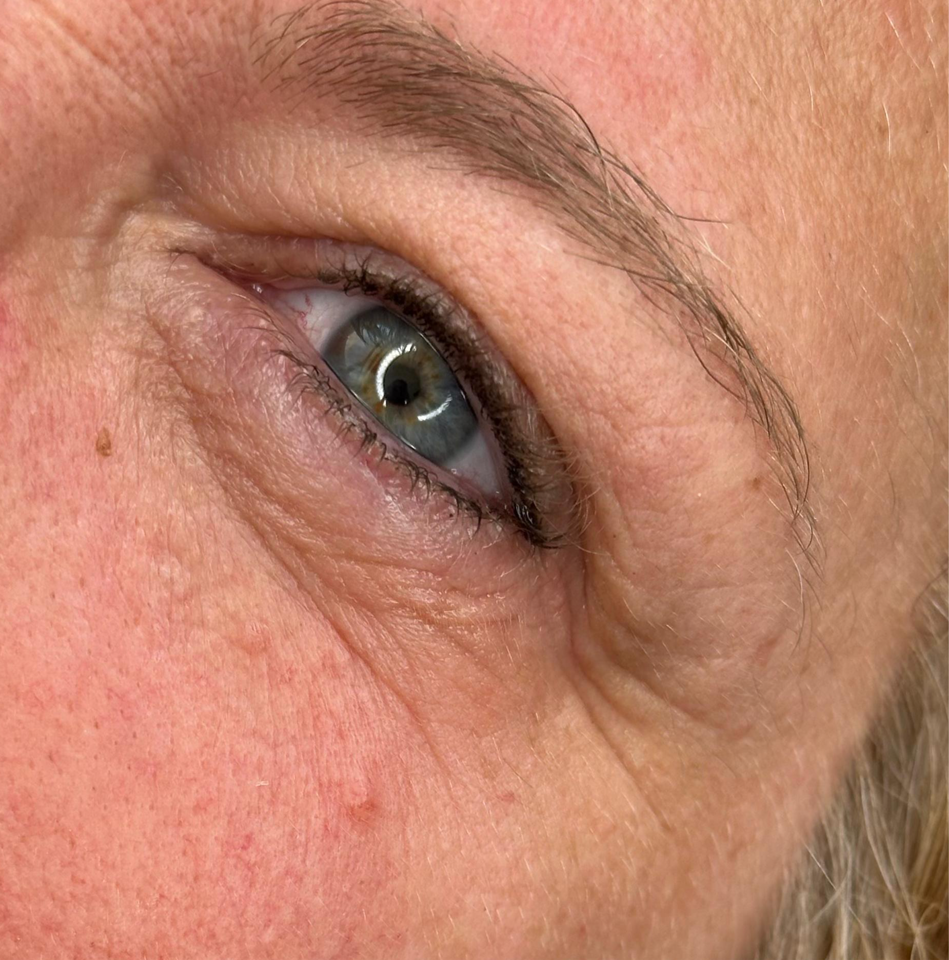 EyeFix Contorno occhi istantaneo