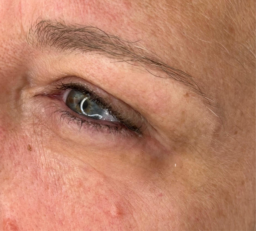 EyeFix Contorno occhi istantaneo