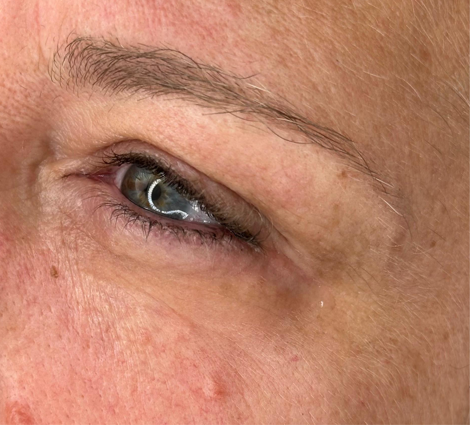 EyeFix Contorno occhi istantaneo