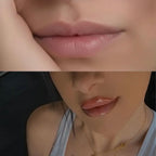 KIT LIPFINITY 2.0 - Microneedling labbra