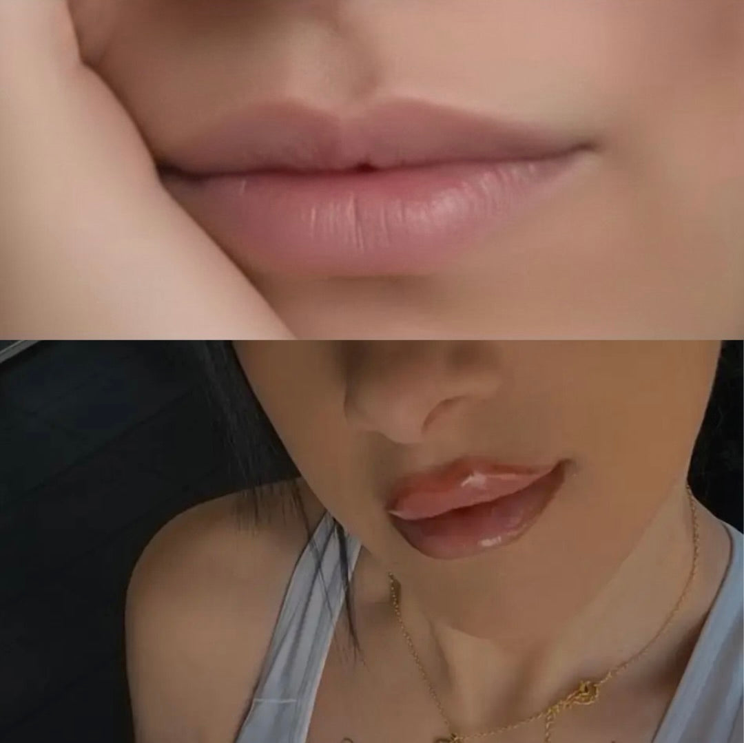 KIT LIPFINITY 2.0 - Microneedling labbra