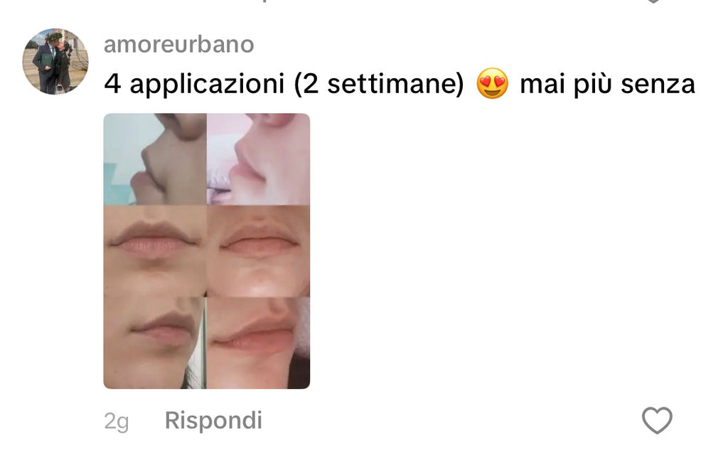 Kit Microneedling Labbra, Smagliature e Rughe